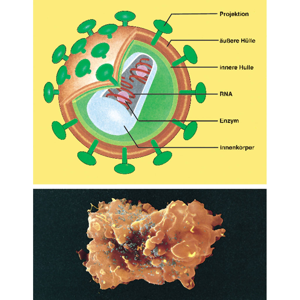 AIDS - Immunologie