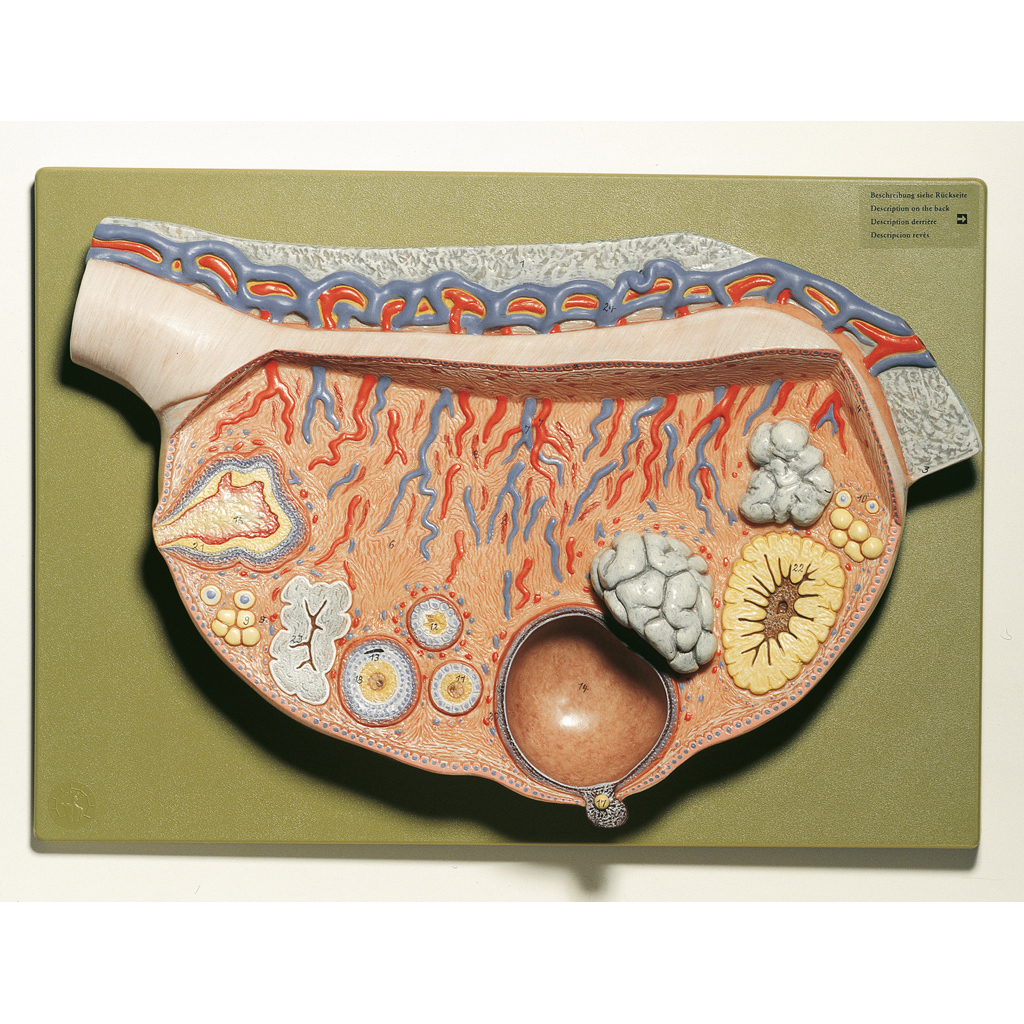 temp2136xb0Uiv3hV1qE2 Reliefmodell vom Eierstock