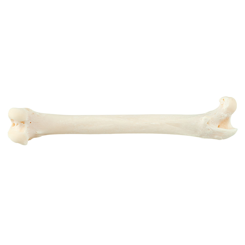 Knochenbelastbarkeit, Ersatzknochen