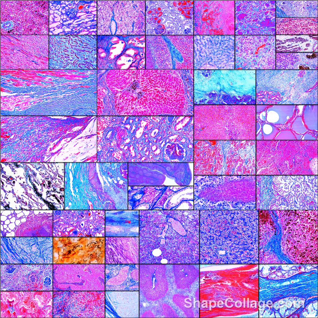 tempmp-s92xx-fflISbEfHZvNDkW Serie 9200 Pathologische Histologie des Menschen