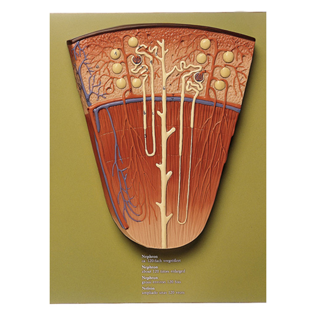 temp2115c5qlsV6HUIQcm Modell vom Nephron