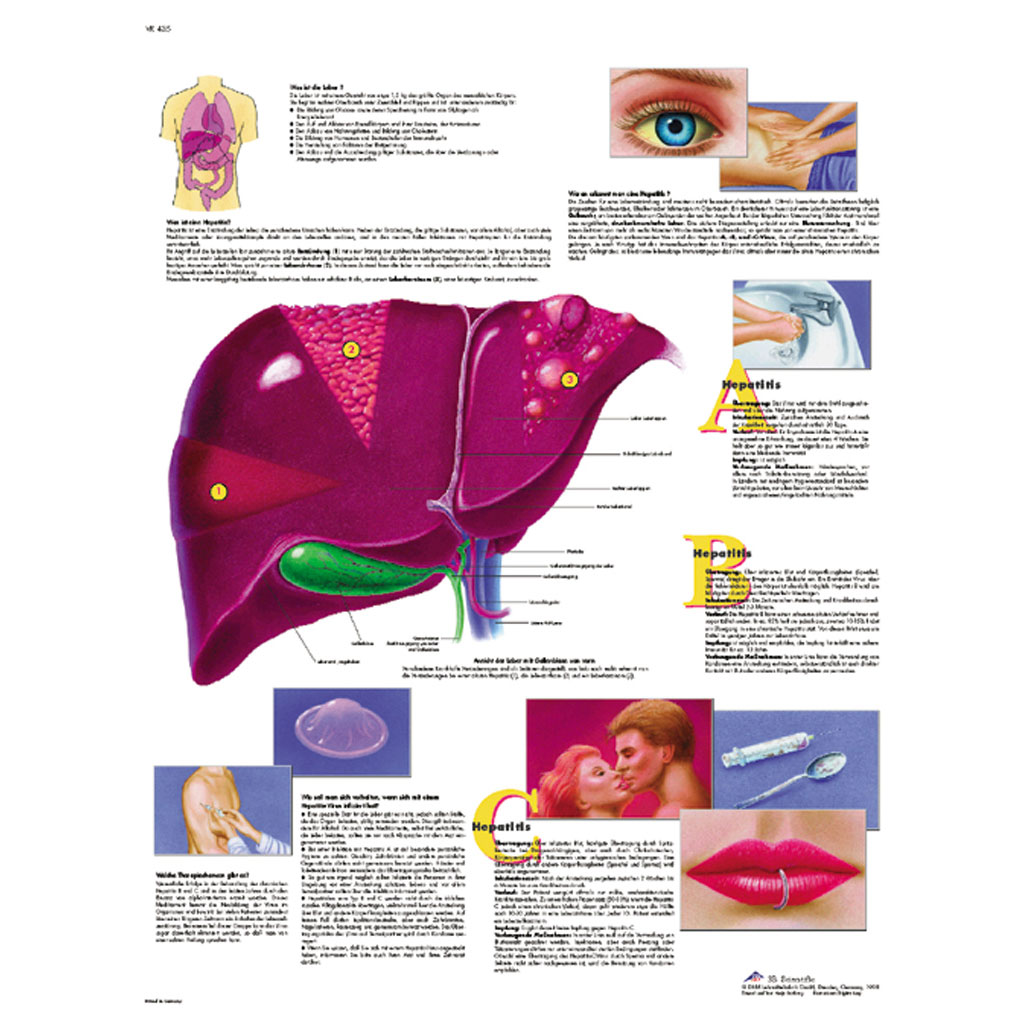 Hepatitis - Poster laminiert