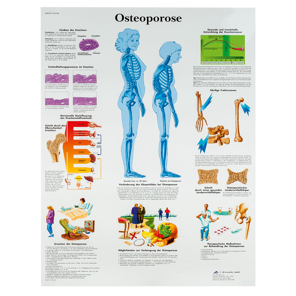Osteoporose - Poster laminiert