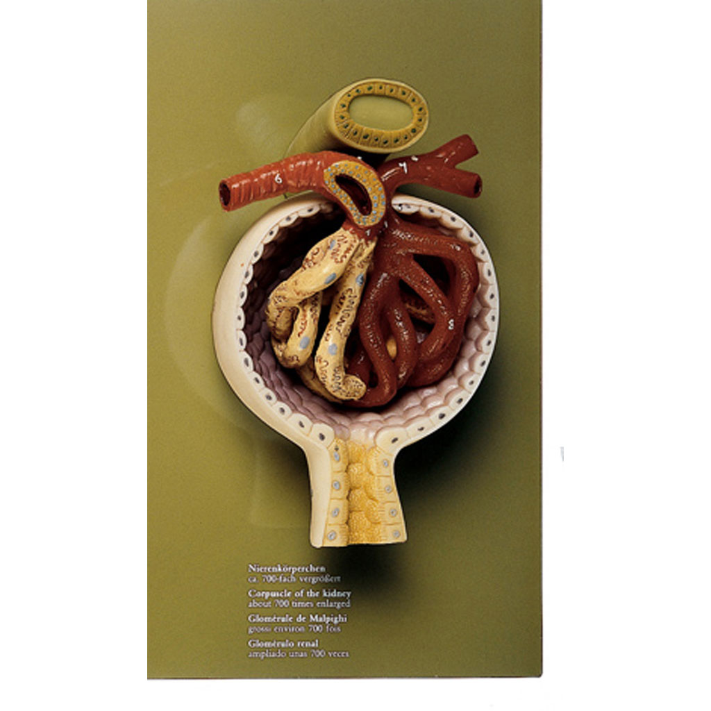 temp2116rjEvuCpHlWOOi Nierenkörperchen