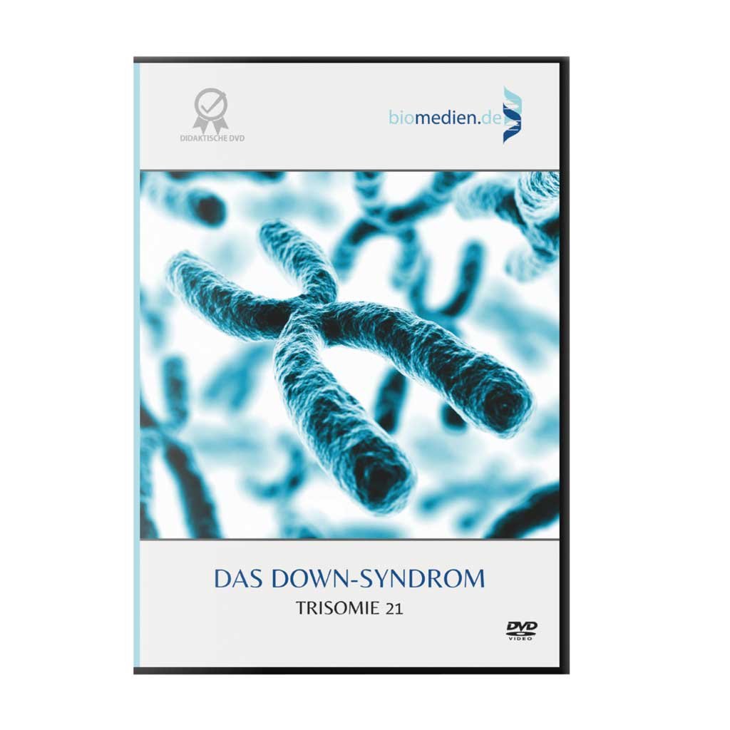Das Down-Syndrom - Trisomie 21