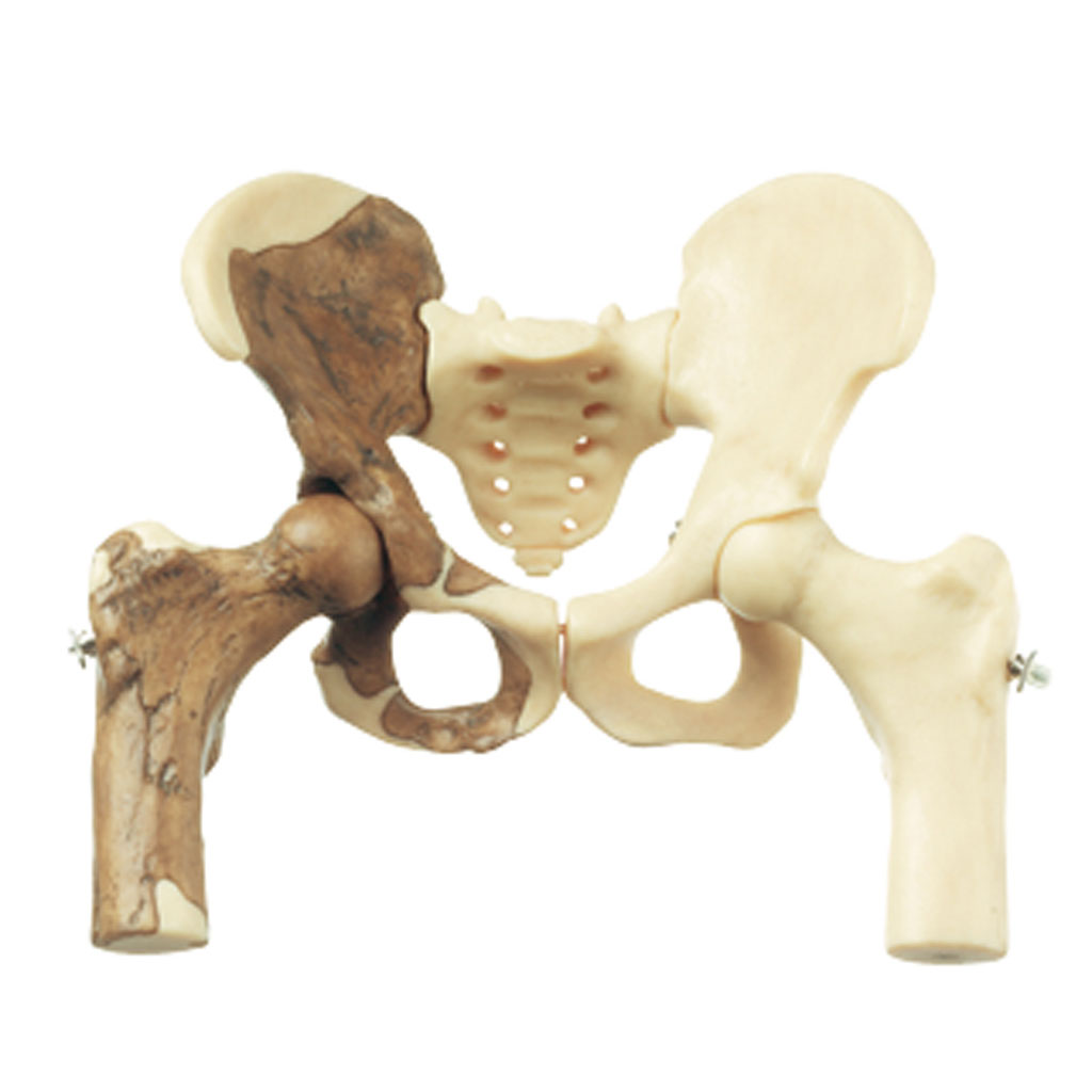 Becken-Rekonstruktion von Australopithecus africanus