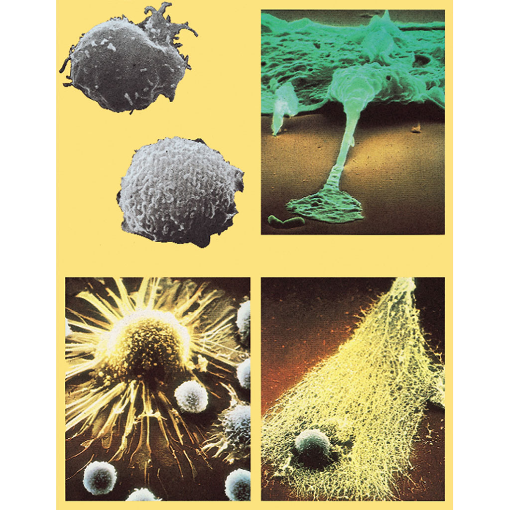 temp2881hmhDkI9YQlG9d Bakterien und Viren - Neue Bedrohungen