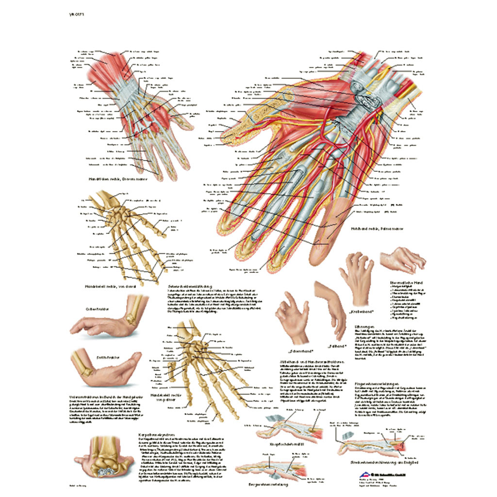 Hand und Handgelenk - Anatomie und Pathologie - Poster