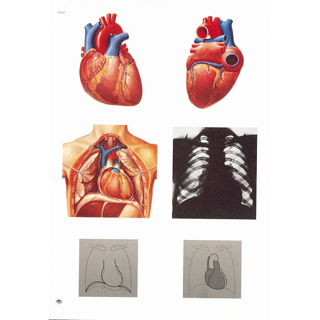 Herz I, Anatomie - mit Holzbestäbung