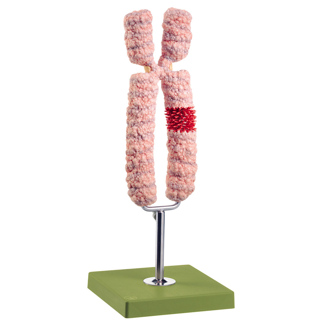 temp21374ZV14sGJdOvmr1 Chromosomenmodell
