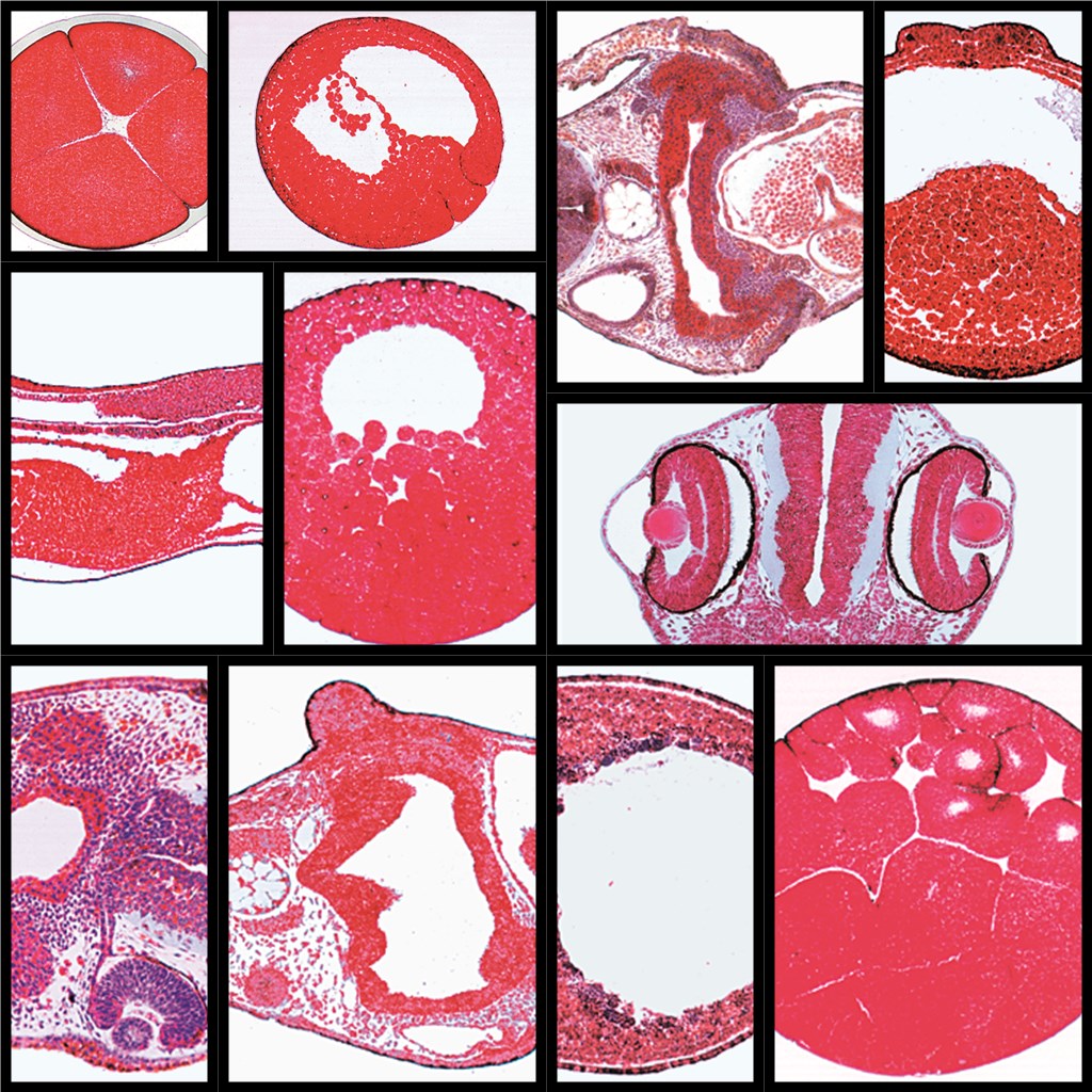Serie 8300 Entwicklung des Froschembryo (Rana)